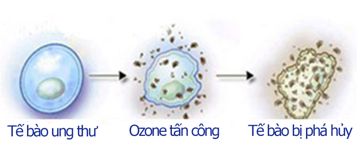 Ozone phá hủy tế bào ung thư
